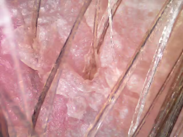 peeling-do